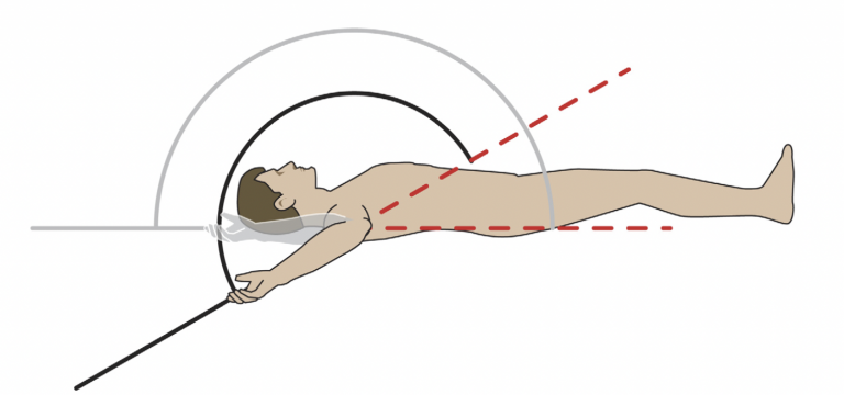 TROM - Glenohumeral internal rotation deficit - GIRD